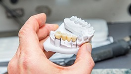 Dentist holding a model of a dental bridge in Wakefield