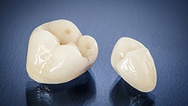 All ceramic dental crowns in Wakefield on blue background